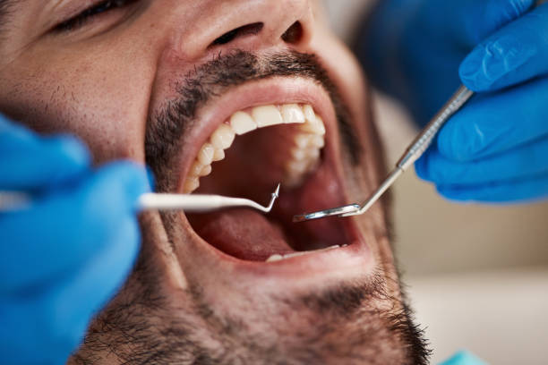 Best Emergency Dental Services for Seniors in Crystal City, MO